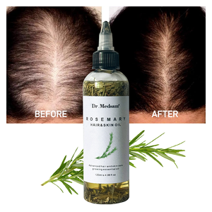 Hair Growth Oil Vegan Natural Herbal Rosemary Hair Growth Oil Nourish Scalp Care Hair Regrowth Serum