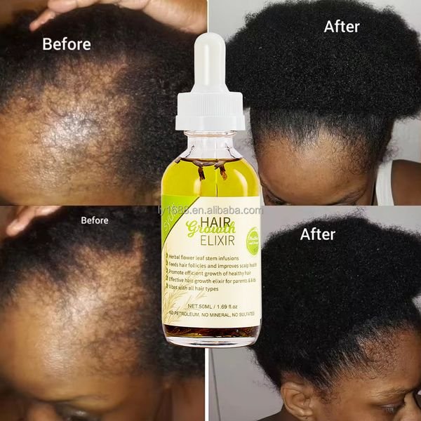 Private Label 100% Natural Organic Scalp Care Hair Products Mix Herbs Rosemary Castor Oil Men Women Baby Hair Growth Oil